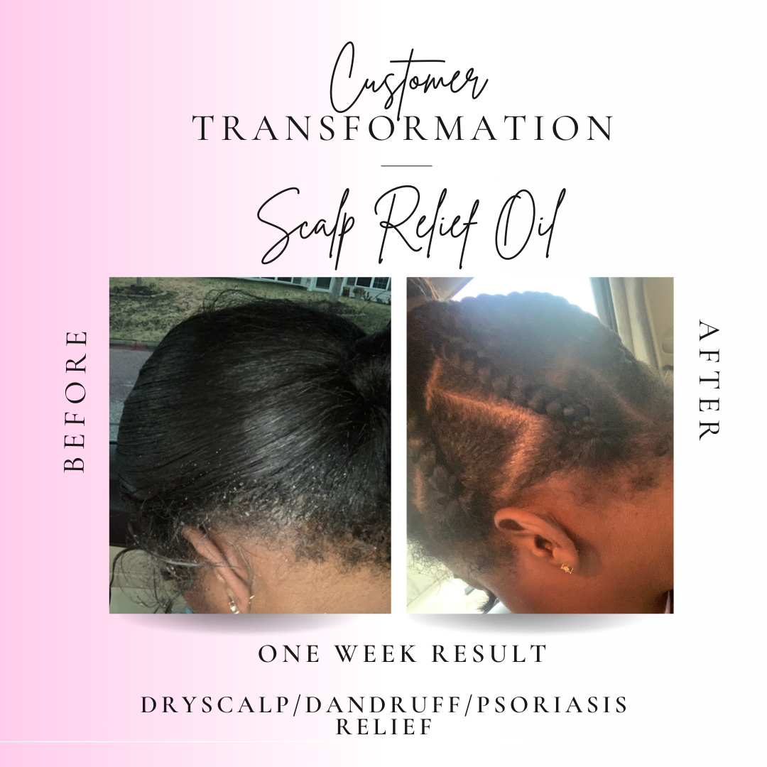 Raesthetics Scalp Relief Oil - 4OZ