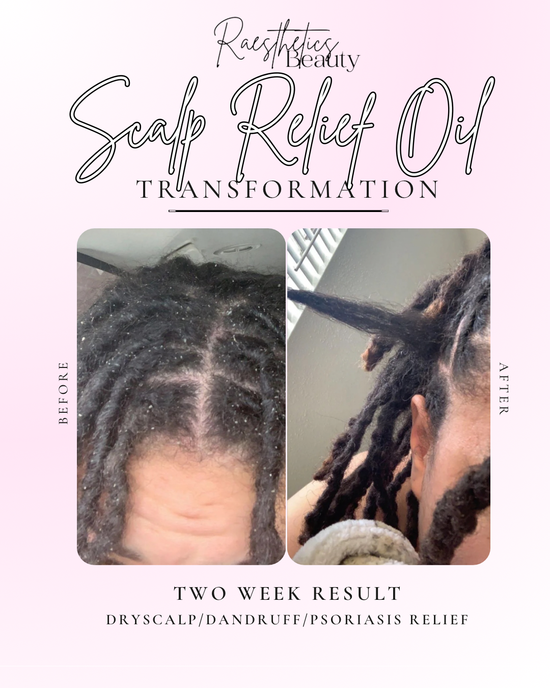 Scalp Relief Oil