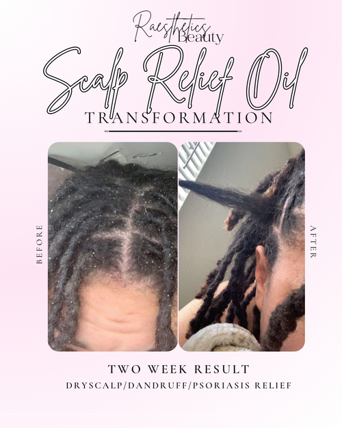 Scalp Relief Oil